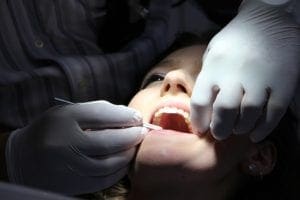 Dental Exam - Asheville Dentists