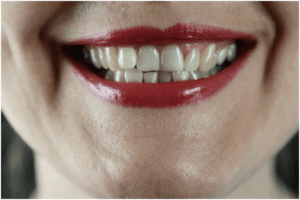 6-benefits-getting-professional-teeth-whitening