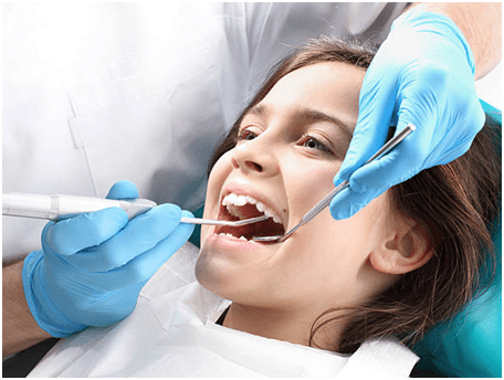Top 8 FAQs About Dental Sealants