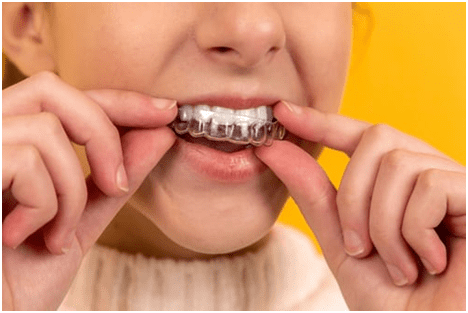 Does My Child Really Need a Custom Mouthguard?