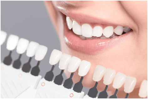 Professional Dental Services Asheville