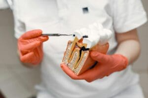 Root canal therapy recovery tips